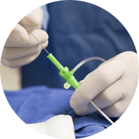 Catheterization